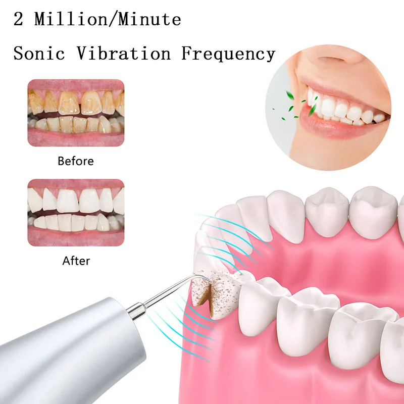 Elektriliste kodumasinate ultraheli hamba scaler visuaalne hamba scaler endoscope hammaste valgendamine hambakivi eemaldaja 4